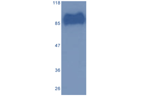 Figure:  MA23 (0.001µg/ml) staining of Hep3B cell lysate (5µg protein in RIPA buffer). Primary incubation at 4℃ overnight, detection by chemiluminescence.